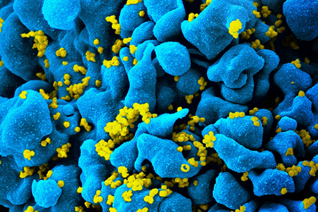 CAR T cells attack HIV infected cells