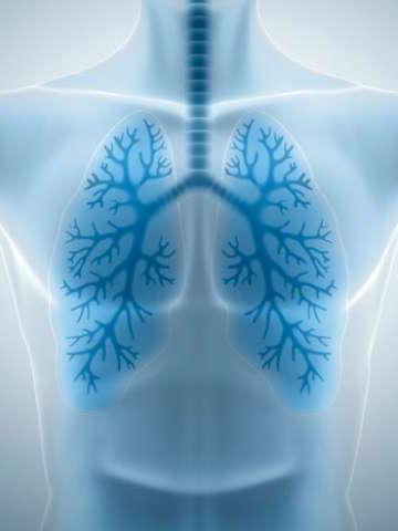 肺部扫描x线图像